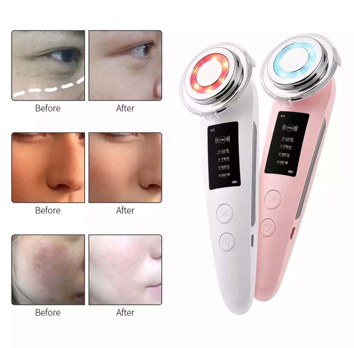Ультразвуковой аппарат для ухода за кожей лица Beauty Instrument оптом