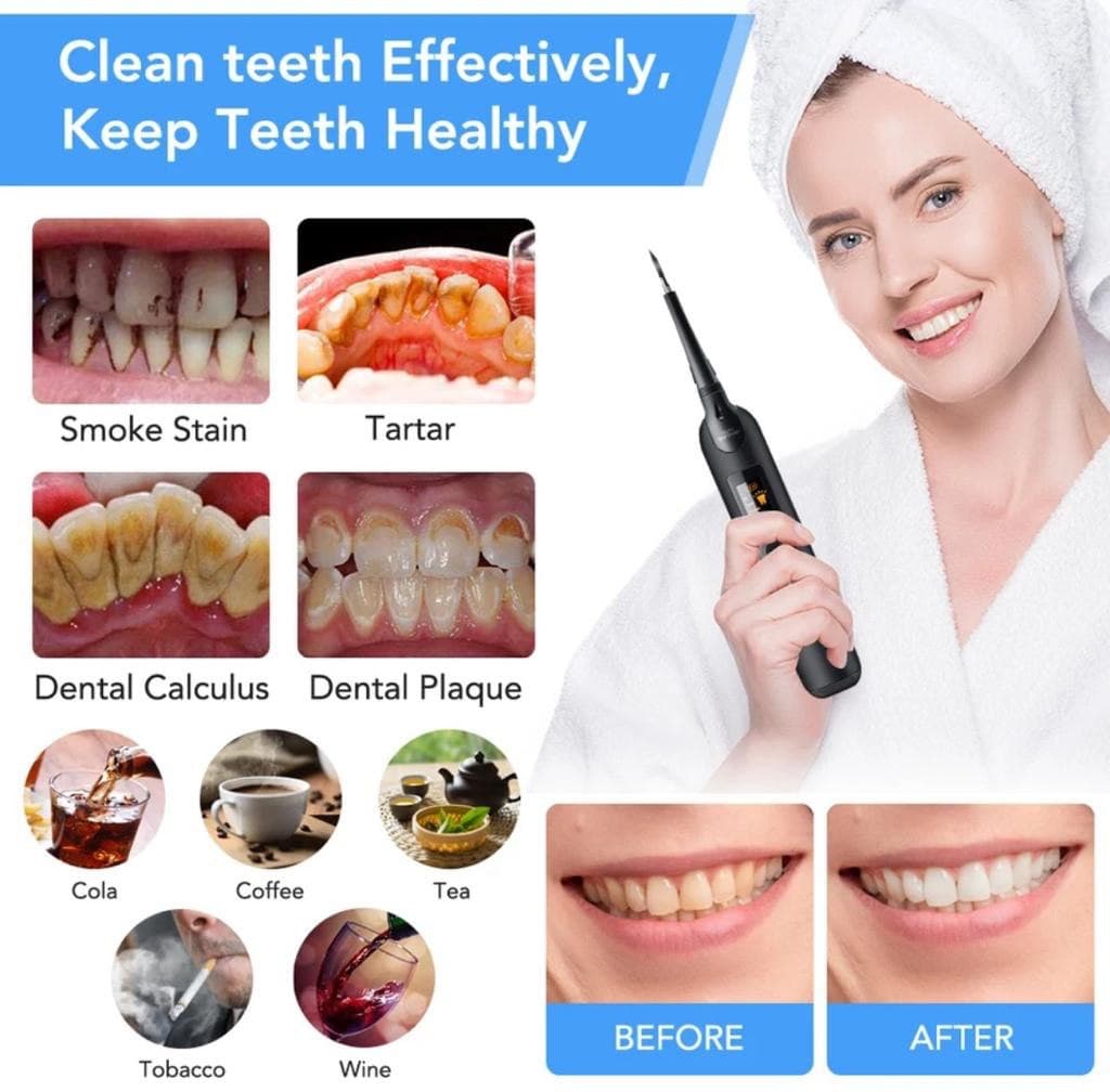 Электрический ультразвуковой прибор для чистки зубов от налета и зубного камня Home-Use Dental Tools оптом - Фото №3