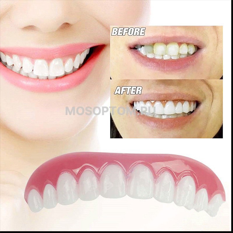 Зубные виниры Perfect Smile Veneers оптом  - Фото №3