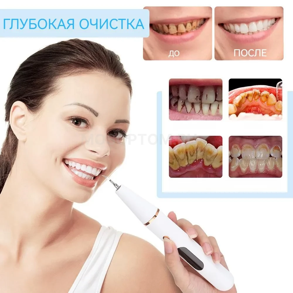 Прибор для профессиональной чистки зубов Home-Use Dental Tools оптом - Фото №5